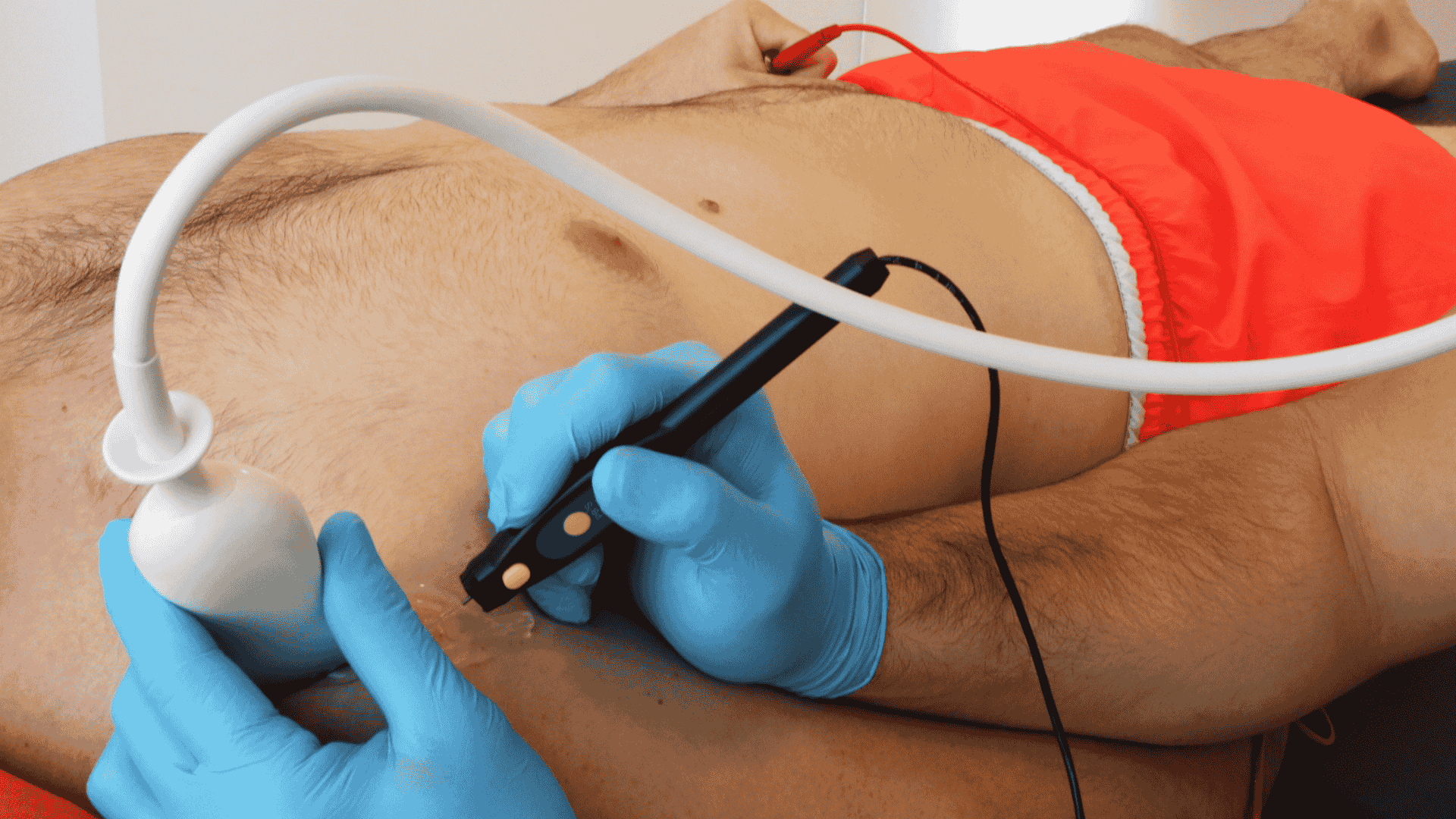 Fisioterapia Invasiva